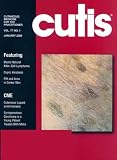 Cutis