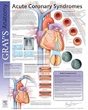 Buy : Acute Coronary Syndrome: Grays Anatomy Poster Series