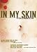 Search : In My Skin