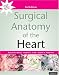 Surgical Anatomy of the Heart