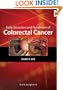 Early Detection and Prevention of Colorectal Cancer (Curbside Consultation)