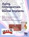 Books : Aging, Osteoporosis, and Dental Implants