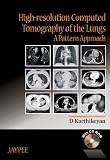 High-resolution Computed Tomography of the Lungs  A Pattern Approach