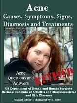 ACNE: REVISED EDITION- CAUSES, SYMPTOMS, SIGNS, DIAGNOSIS AND TREATMENTS-From Free Kindle Books Library Click to Download Free Kindle Book -> ACNE: REVISED EDITION- CAUSES, SYMPTOMS, SIGNS, DIAGNOSIS AND TREATMENTS