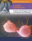 Lung Cancer: Current And Emerging Trends in Detection And Treatment (Cancer and Modern Science)
