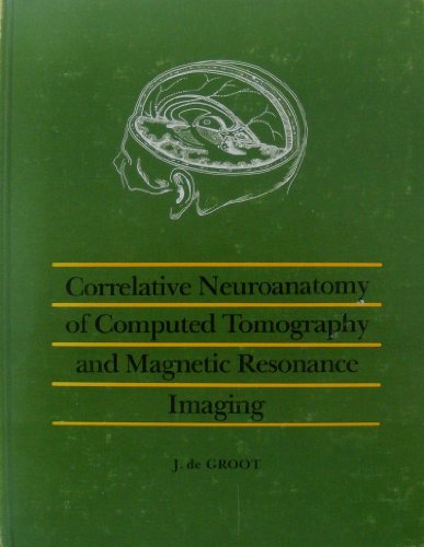 Correlative Neuroanatomy of Computed Tomography and Magnetic Resonance Imaging