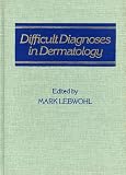 Difficult diagnoses in dermatology