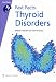 Fast Facts: Thyroid Disorders (Fast Facts series)