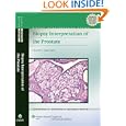 Biopsy Interpretation of the Prostate (Biopsy Interpretation... by Jonathan I. Epstein and George J. Netto