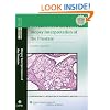 Biopsy Interpretation of the Prostate (Biopsy Interpretation Series)