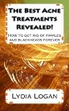 The Best Acne Treatments Revealed!: How to get rid of pimples and blackheads forever!