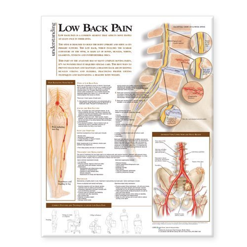Understanding Low Back Pain Anatomical Chart by (2008-11-10)