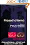 Mesothelioma