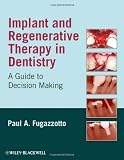 Implant and Regenerative Therapy in Dentistry: A Guide to Decision Making Reviews