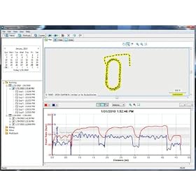 Garmin Forerunner 305 Variation Parent