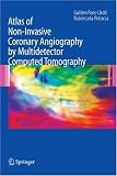 Atlas of Non-Invasive Coronary Angiography by Multidetector Computed Tomography (Developments in Cardiovascular Medicine)