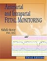 Antepartal and Intrapartal Fetal Monitoring: Third Edition