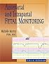 Antepartal and Intrapartal Fetal Monitoring: Third Edition