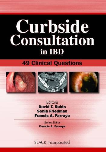 Curbside Consultation in IBD: 49 Clinical Questions