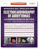 Electrocardiography of Arrhythmias: A Comprehensive Review: A Companion to Cardiac Electrophysiology: Expert Consult - Online and Print, 1e