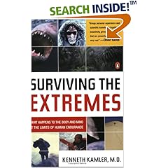 external image 51D09EDR88L._SL500_BO2,204,203,200_PIsitb-dp-500-arrow,TopRight,45,-64_OU01_AA240_SH20_.jpg