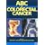 ABC of Colorectal Cancer (ABC Series)
