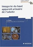 Imagerie du haut appareil urinaire de l'adulte