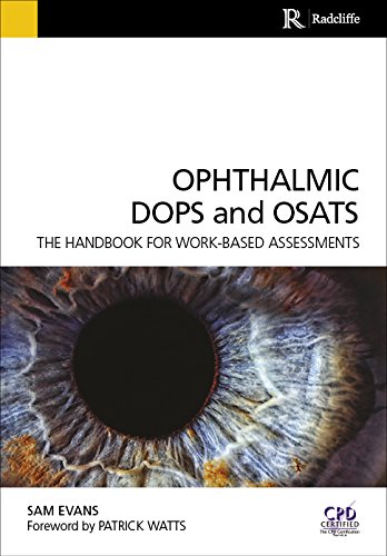 Ophthalmic DOPS and OSATS Ebook: The handbook for work-based assessments