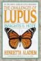 The Challenges of Lupus: Insights and Hope