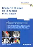 Imagerie clinique de la hanche et du bassin