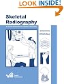 Skeletal Radiography: A Concise Introduction to Projection Radiography