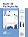 Skeletal Radiography: A Concise Introduction to Projection Radiography