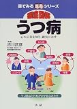 徹底図解 うつ病―心の正体を知り、確実に治す (目でみる医書シリーズ)