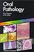 Oral Pathology