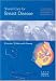 Shared Care For Breast Disease (Shared care)
