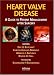 Heart Valve Disease: A Guide to Patient Management After Surgery