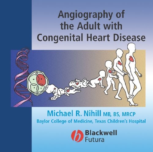 Congenital-Heart-Disease