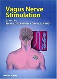 Vagus Nerve Stimulation