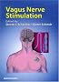 Vagus Nerve Stimulation Vagus Nerve Stimulation
