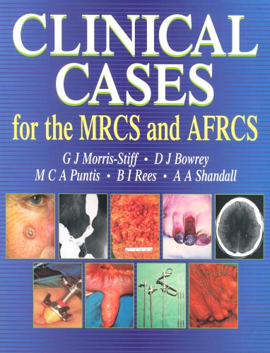 Clinical Cases for the MRCS and AFRCS