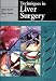 Book Techniques in Liver Surgery