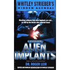 Casebook: Alien Implants