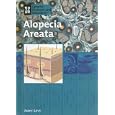 Alopecia Areata (Genetic Diseases) by  Janey Levy