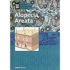 Click here to buy Alopecia Areata (Genetic Diseases) by Janey Levy.