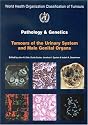 WHO Classification of Tumours: Pathology and Genetics of Tumours of the Urinary System and Male Genital Organs (IARC WHO Classification of Tumours)