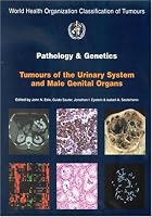 WHO Classification of Tumours: Pathology and Genetics of Tumours of the Urinary System and Male Genital Organs (World Health Organization Classification of Tumours)