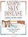 Atopic&nbsp;Skin&nbsp;Disease:&nbsp;A&nbsp;Manual&nbsp;For&nbsp;Practitioners