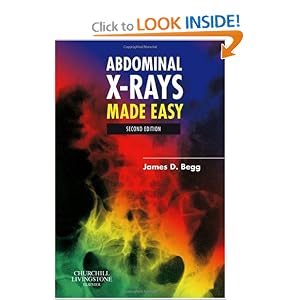 Click here to buy Abdominal X-Rays Made Easy by James D. Begg MB BS FRCR.