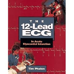 The 12-Lead ECG in Acute Myocardial Infarction