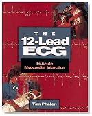 The 12-Lead ECG: In Acute Myocardial Infarction